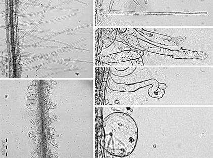 Effects of under- or overexpressing a PI4P 5-kinase on development and polarity of root hairs in Arabidopsis thaliana. Left, Wild type (top) and pip5k3-4 mutant (bottom). Right, Wild type (top) and progressive loss of polarity in root hairs with increasing levels of expression. (from Stenzel et al., Plant Cell 20, 124-141, 2008)